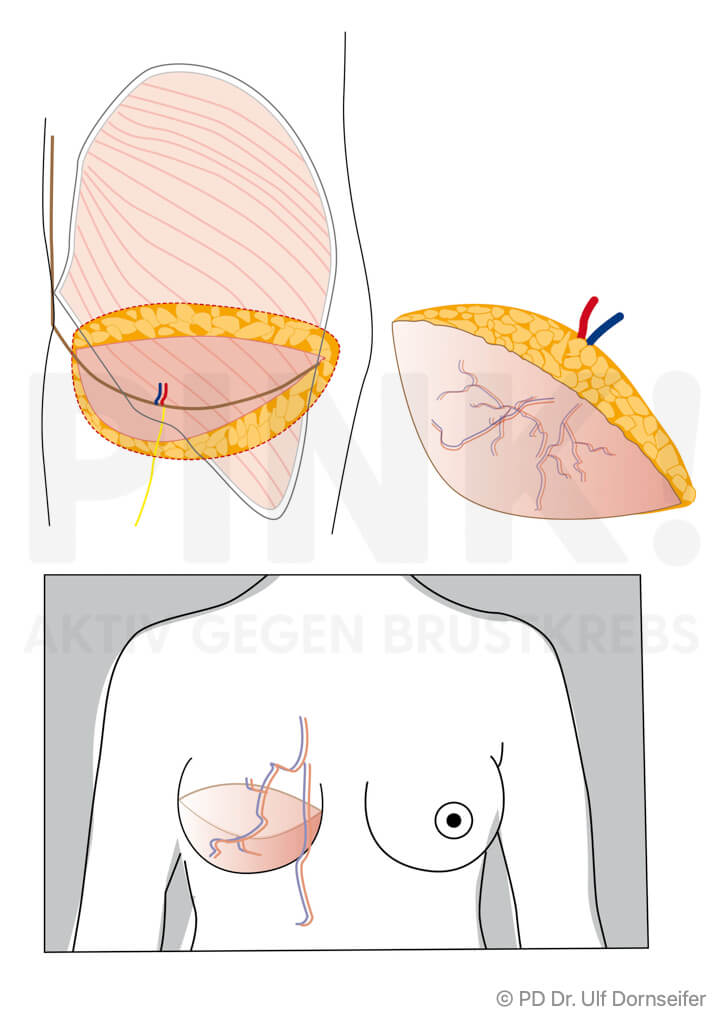 FCI Lappen
